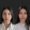 #1 (4) Facial Implants, 22 y.o., 8 days