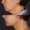#3 Chin Implant, 42 years old, 9 days