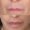 #4 Lip Lift, 58 y.o., 2 months