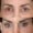 #4 Up. Eyelid, 58 y.o., 2 months