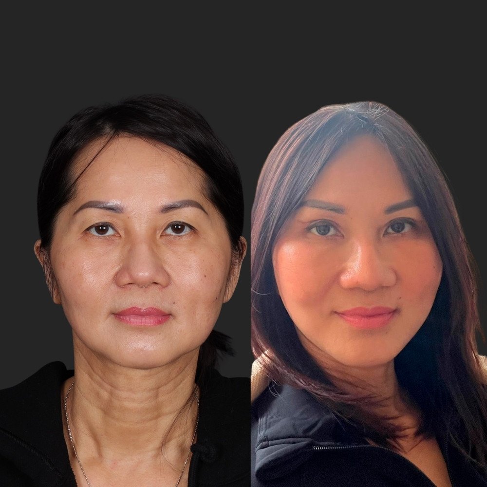 thao1000x1000
